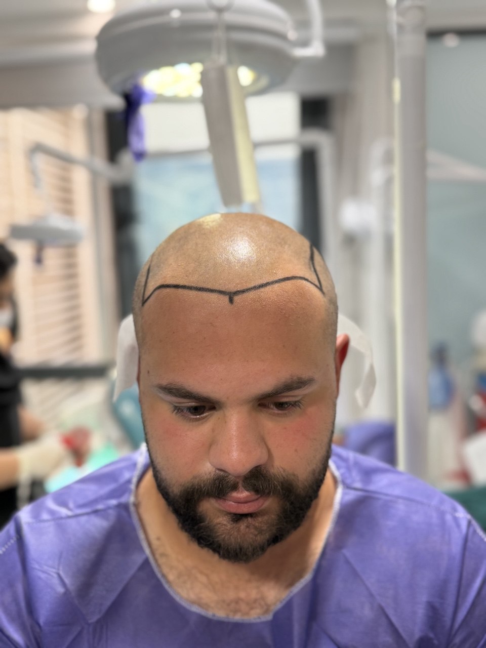 قبل